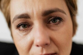 Totul despre epifora (lăcrimarea ochilor): cauze, simptome, metode de tratament și opțiuni terapeutice