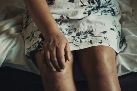 Edemul limfatic la picioare (Limfedem): Simptome ale blocajului limfatic, cauze și soluții eficiente pentru tratare și prevenție