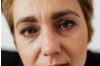 Totul despre epifora (lăcrimarea ochilor): cauze, simptome, metode de tratament și opțiuni terapeutice